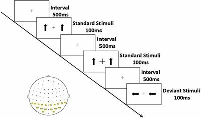 Theta Oscillations Related to Orientation Recognition in Unattended Condition: A vMMN Study